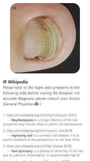 Download Model Dermatol Terbaru – Cek Penyakit Kulit Gratis description image 14