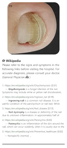 Download Model Dermatol Terbaru – Cek Penyakit Kulit Gratis description image 1