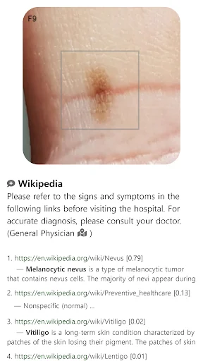 Download Model Dermatol Terbaru – Cek Penyakit Kulit Gratis description image 10